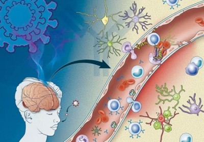 美研究揭「腦霧」秘密 新冠抗體攻擊傷腦血管